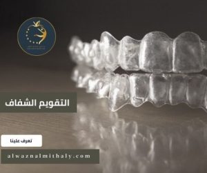 التقويم الشفاف التقويم الشفاف